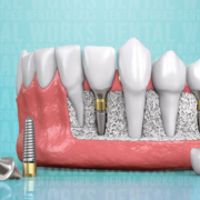 OroCare-Orthodontic-and-Implant-Dental-Centre.png